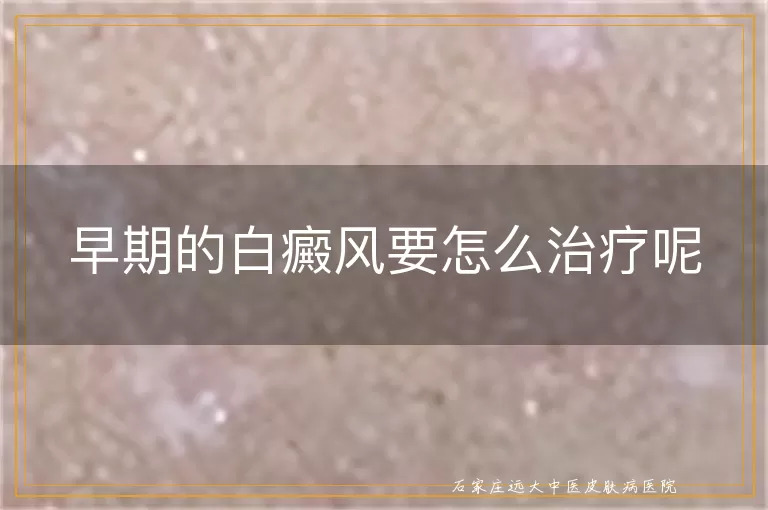 早期的白癜风要怎么治疗呢