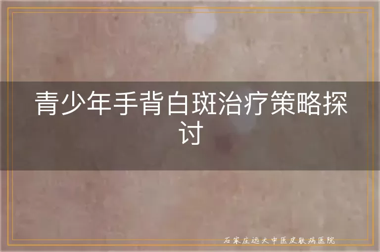 青少年手背白斑治疗策略探讨