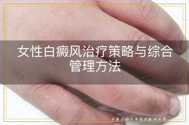女性白癜风治疗策略与综合管理方法