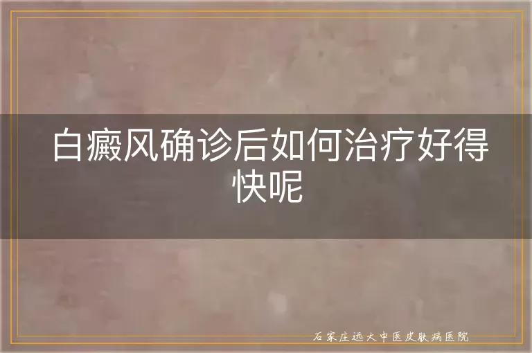 白癜风确诊后如何治疗好得快呢