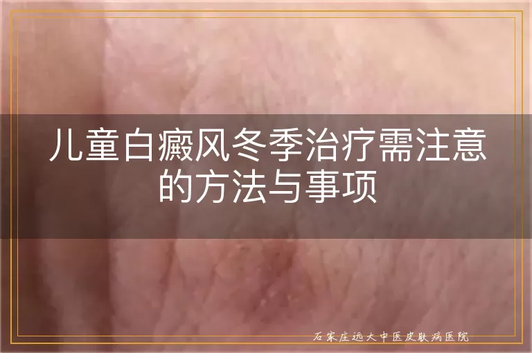 儿童白癜风冬季治疗需注意的方法与事项