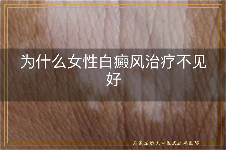 为什么女性白癜风治疗不见好