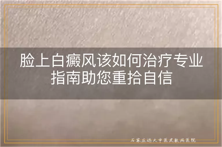 脸上白癜风该如何治疗专业指南助您重拾自信
