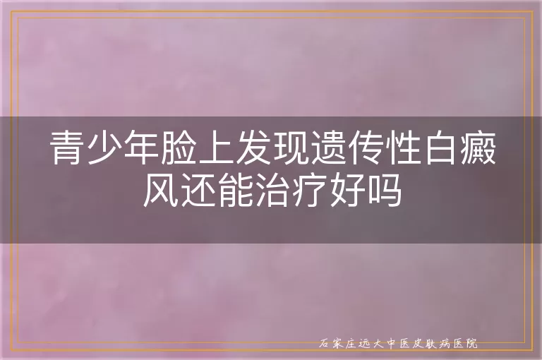 青少年脸上发现遗传性白癜风还能治疗好吗
