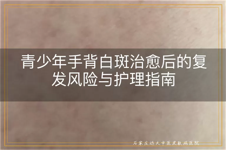青少年手背白斑治愈后的复发风险与护理指南