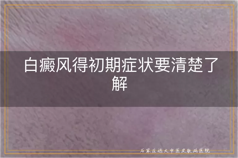 白癜风得初期症状要清楚了解