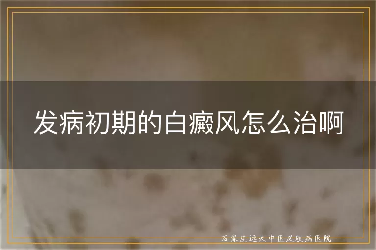 发病初期的白癜风怎么治啊