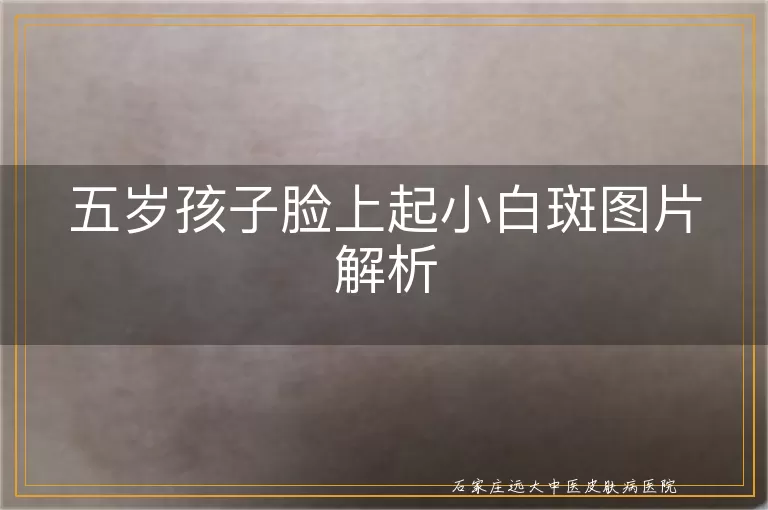 五岁孩子脸上起小白斑图片解析