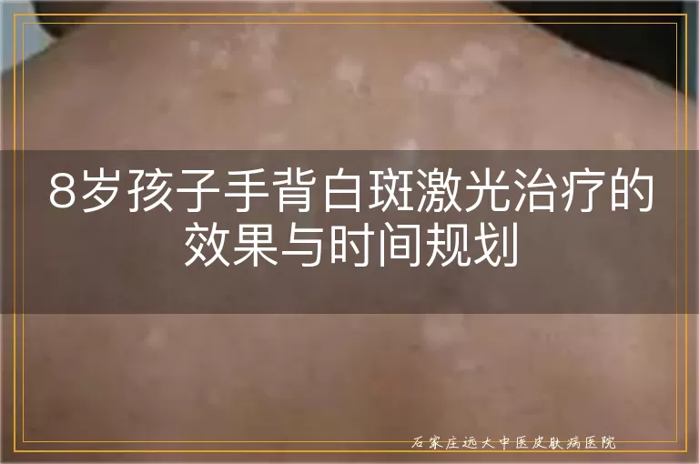 8岁孩子手背白斑激光治疗的效果与时间规划