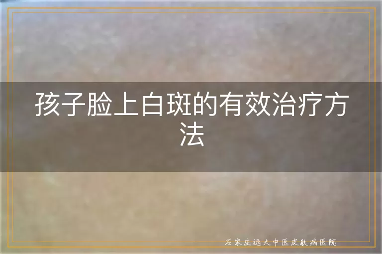 孩子脸上白斑的有效治疗方法