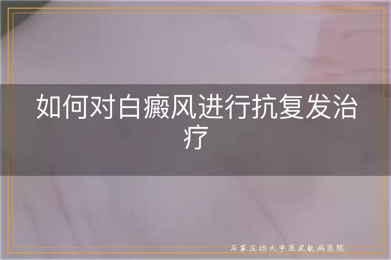 如何对白癜风进行抗复发治疗