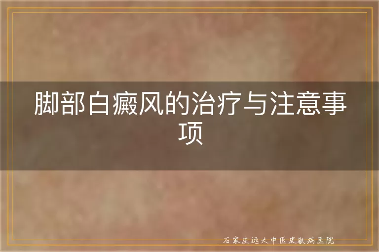 脚部白癜风的治疗与注意事项