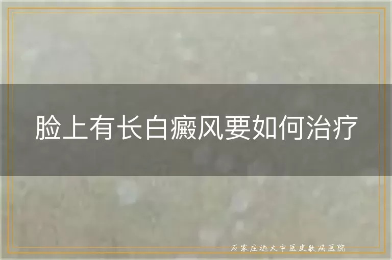 脸上有长白癜风要如何治疗