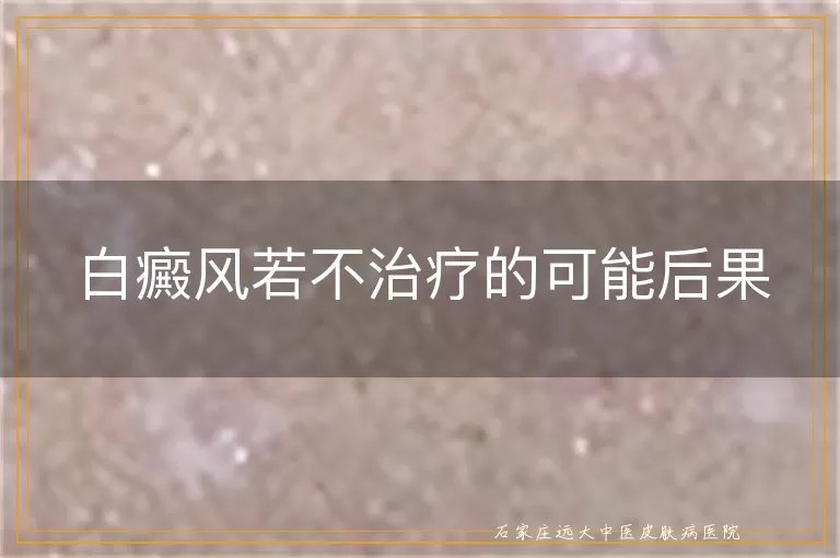 白癜风若不治疗的可能后果