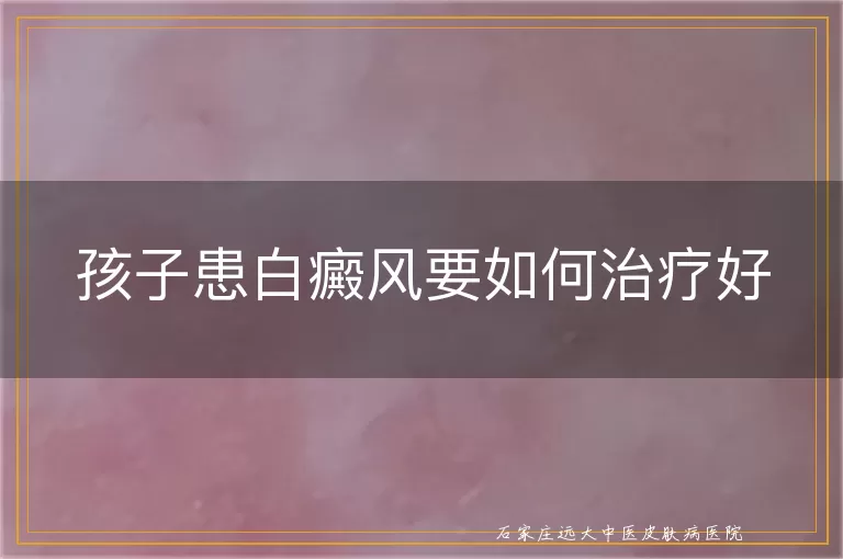 孩子患白癜风要如何治疗好