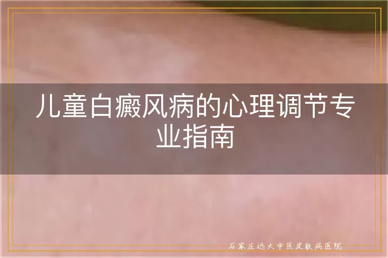 儿童白癜风病的心理调节专业指南