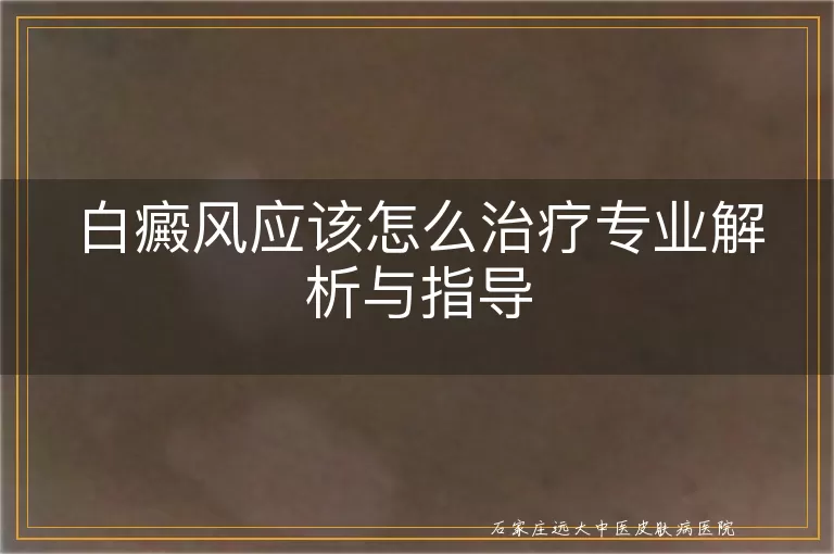 白癜风应该怎么治疗专业解析与指导