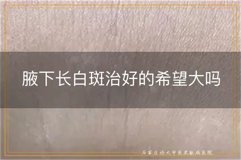 腋下长白斑治好的希望大吗