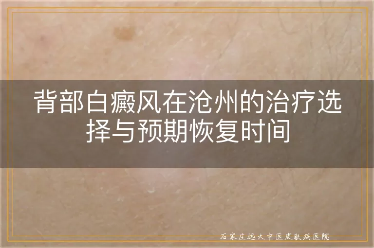 背部白癜风在沧州的治疗选择与预期恢复时间