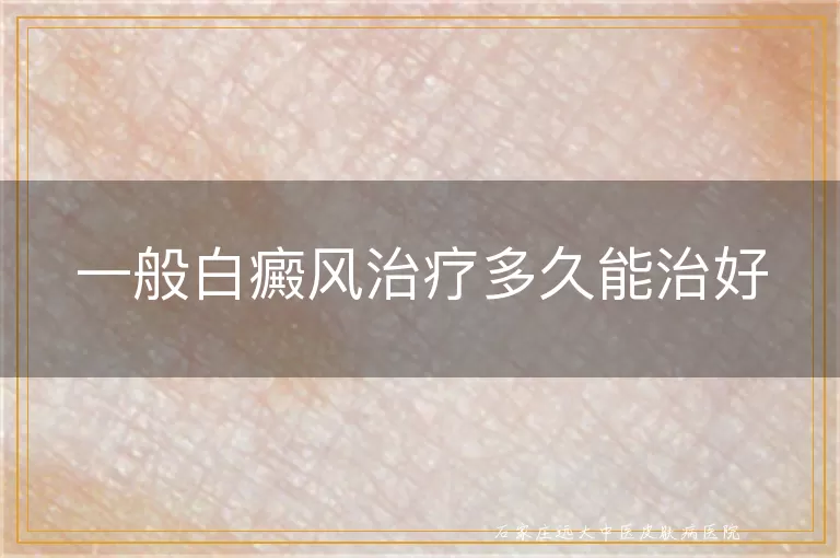 一般白癜风治疗多久能治好