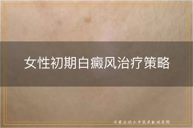 女性初期白癜风治疗策略