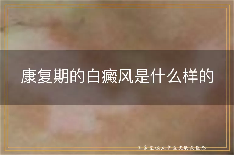 康复期的白癜风是什么样的