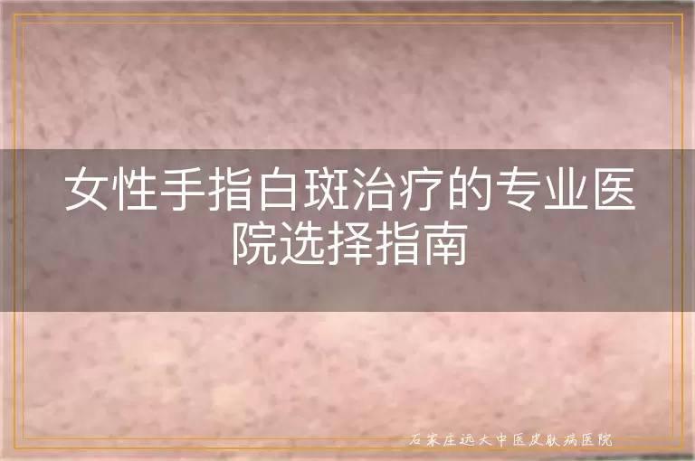 女性手指白斑治疗的专业医院选择指南