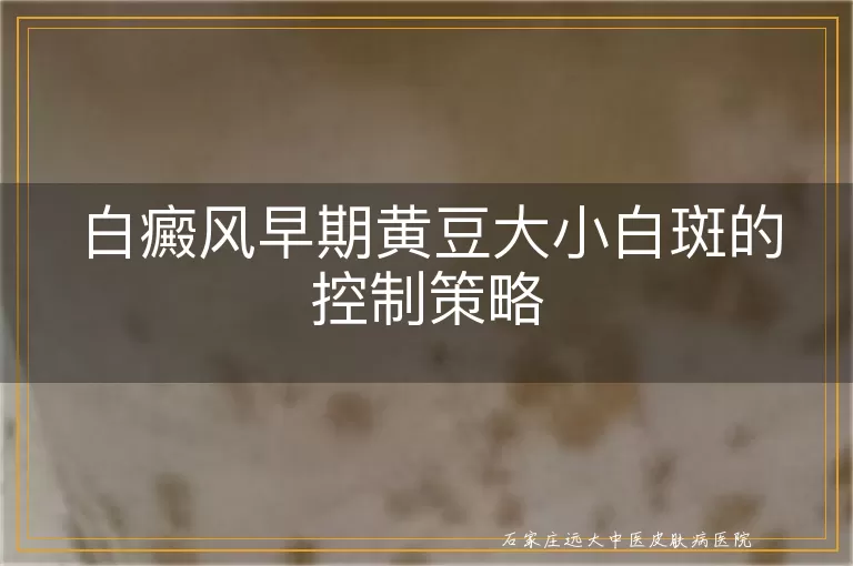 白癜风早期黄豆大小白斑的控制策略