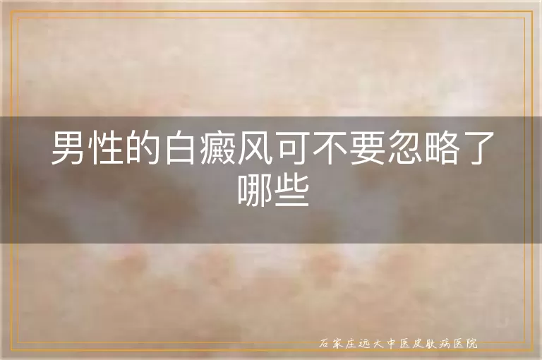 男性的白癜风可不要忽略了哪些