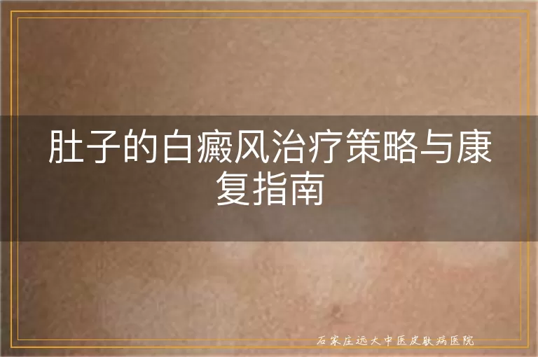 肚子的白癜风治疗策略与康复指南
