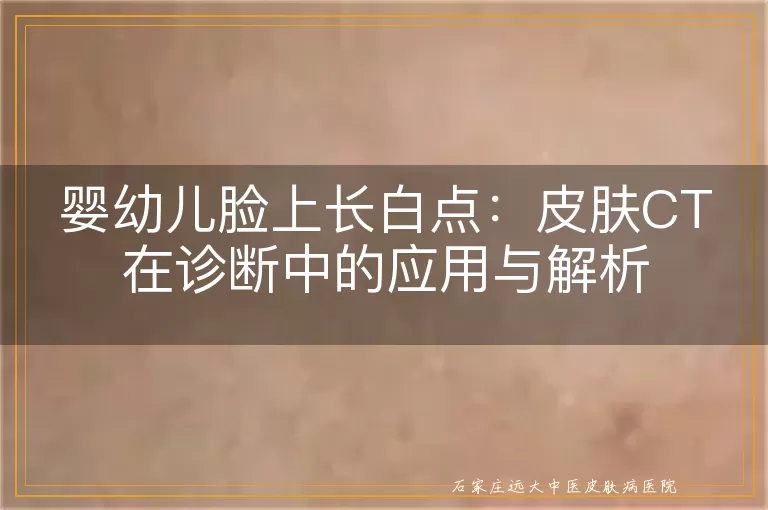 婴幼儿脸上长白点：皮肤CT在诊断中的应用与解析