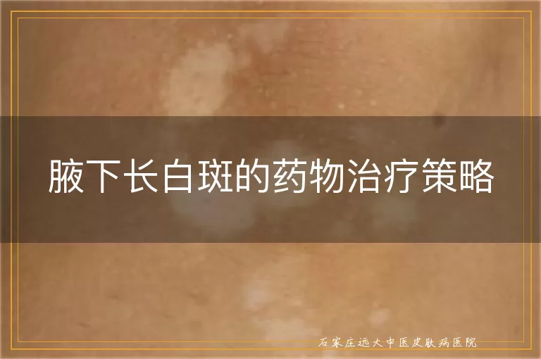 腋下长白斑的药物治疗策略