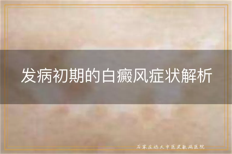 发病初期的白癜风症状解析