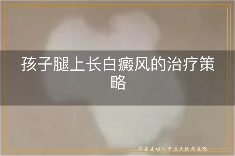 孩子腿上长白癜风的治疗策略