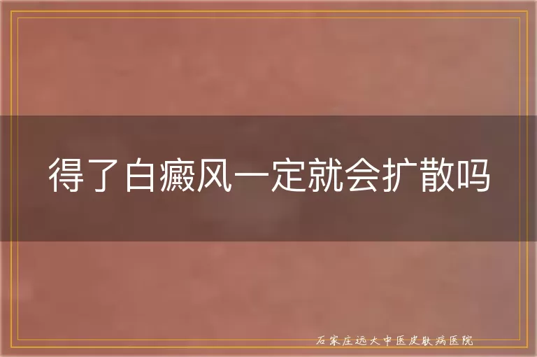 得了白癜风一定就会扩散吗