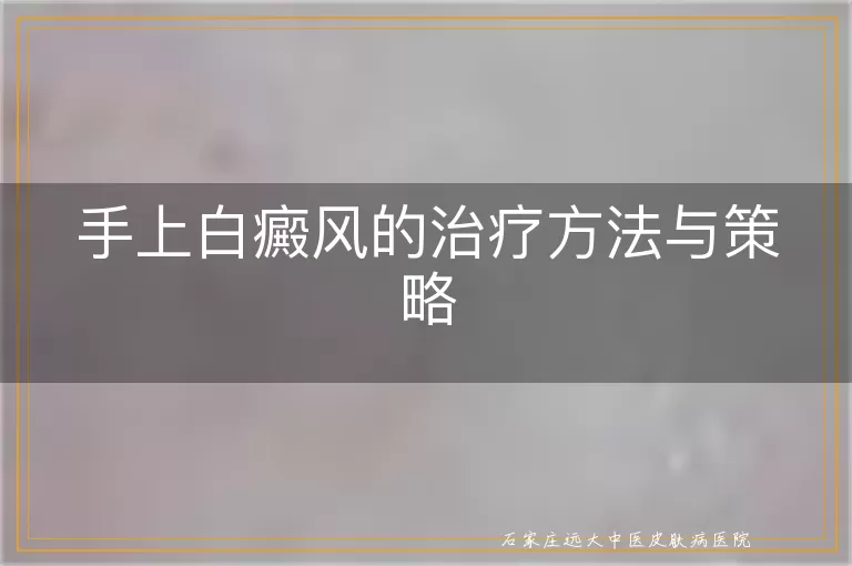 手上白癜风的治疗方法与策略