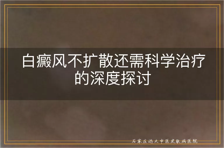 白癜风不扩散还需科学治疗的深度探讨