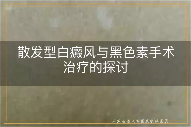 散发型白癜风与黑色素手术治疗的探讨