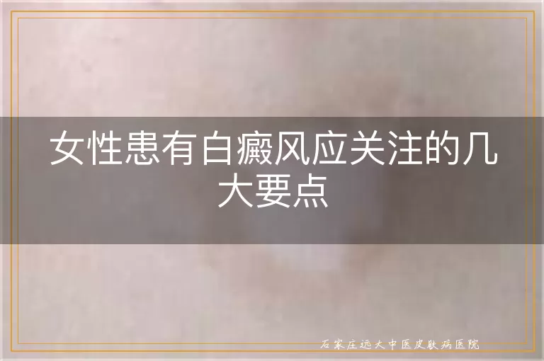 女性患有白癜风应关注的几大要点