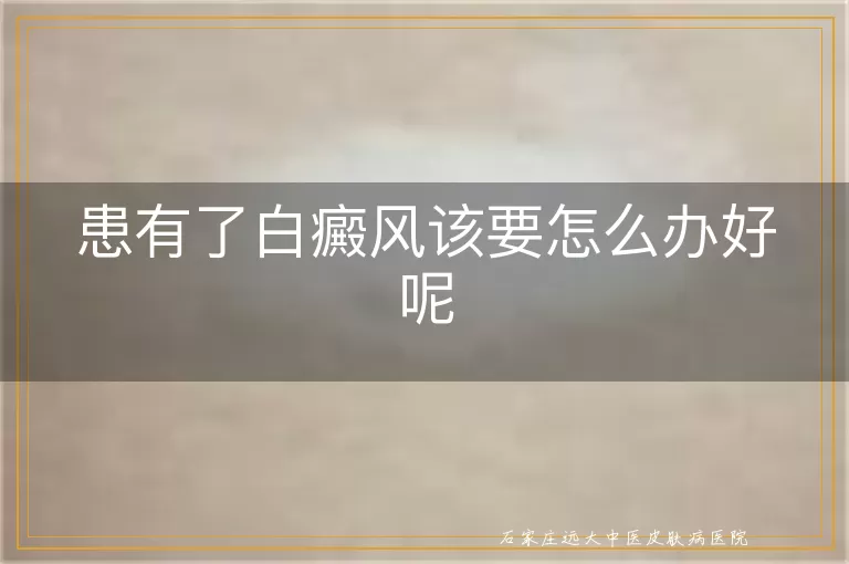 患有了白癜风该要怎么办好呢