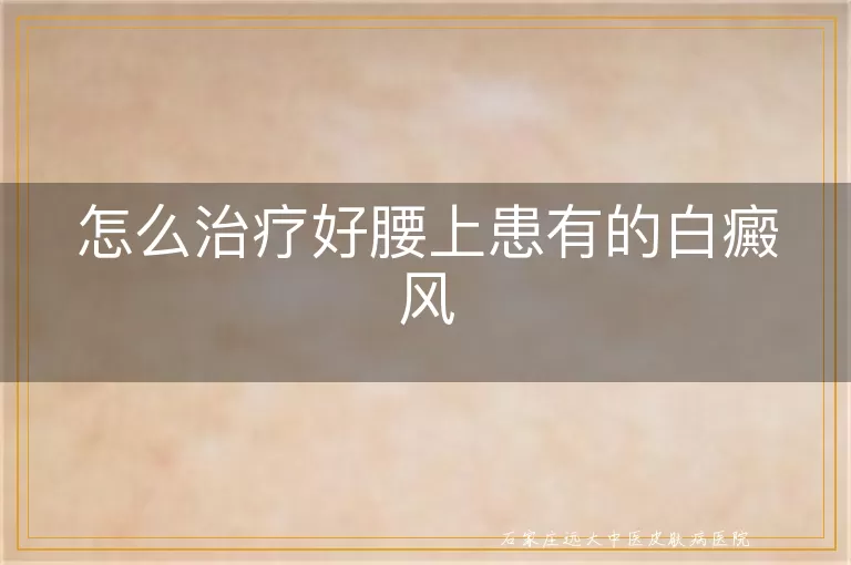 怎么治疗好腰上患有的白癜风
