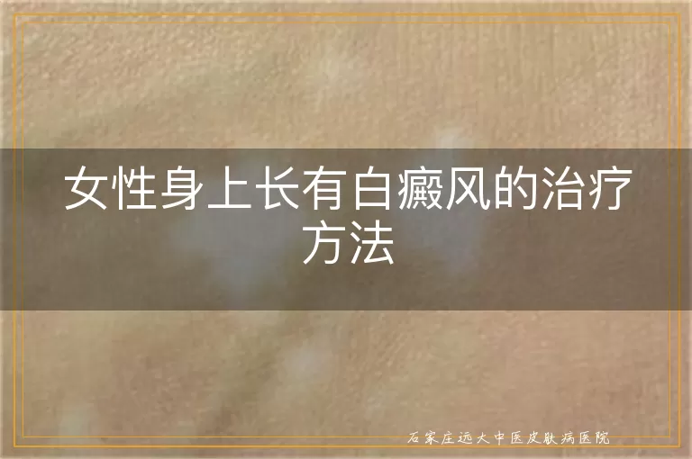 女性身上长有白癜风的治疗方法