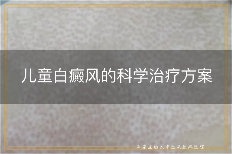 儿童白癜风的科学治疗方案