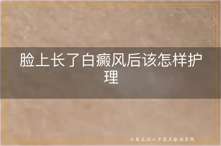 脸上长了白癜风后该怎样护理