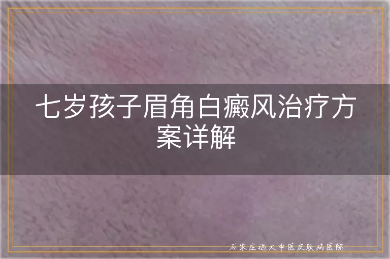 七岁孩子眉角白癜风治疗方案详解