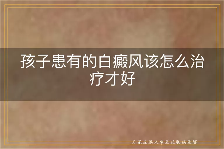 孩子患有的白癜风该怎么治疗才好