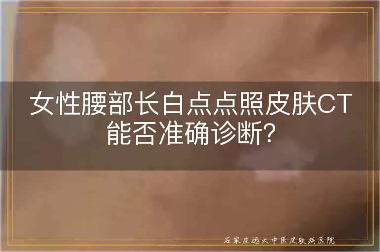 女性腰部长白点点照皮肤CT能否准确诊断？