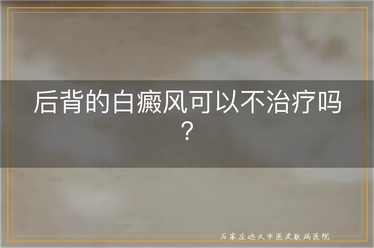 后背的白癜风可以不治疗吗？