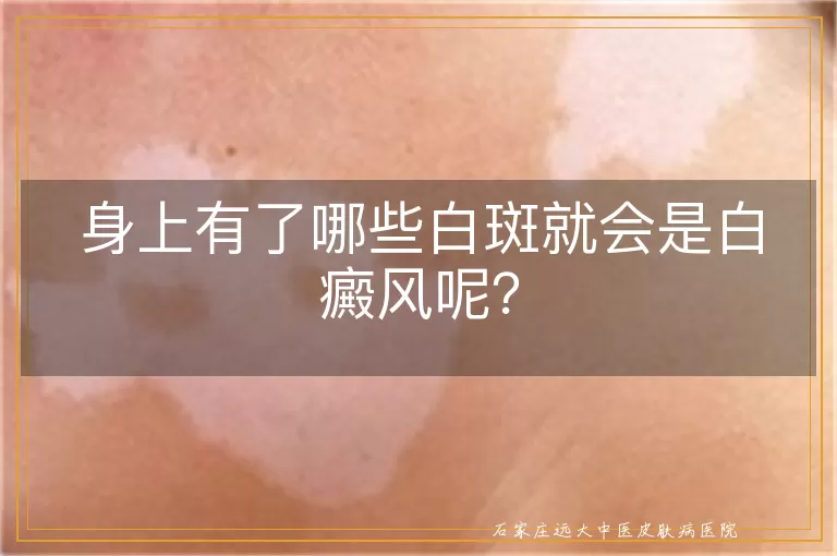 身上有了哪些白斑就会是白癜风呢？