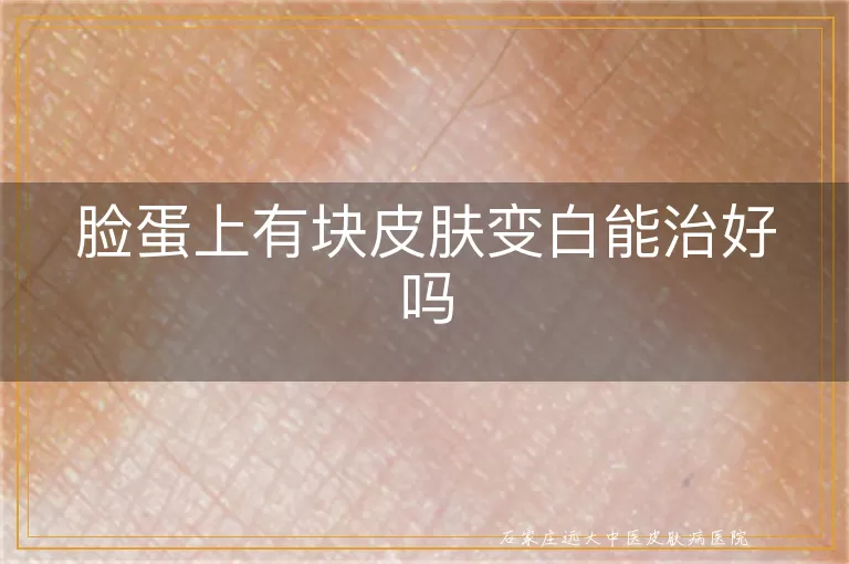 脸蛋上有块皮肤变白能治好吗